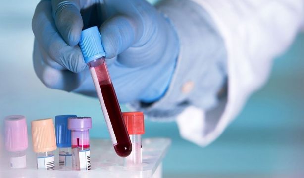 Detectar la diabetes a los 50 años puede reducir la esperanza de vida hasta en ocho años