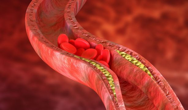 Un nuevo tratamiento reduce a la mitad el colesterol malo