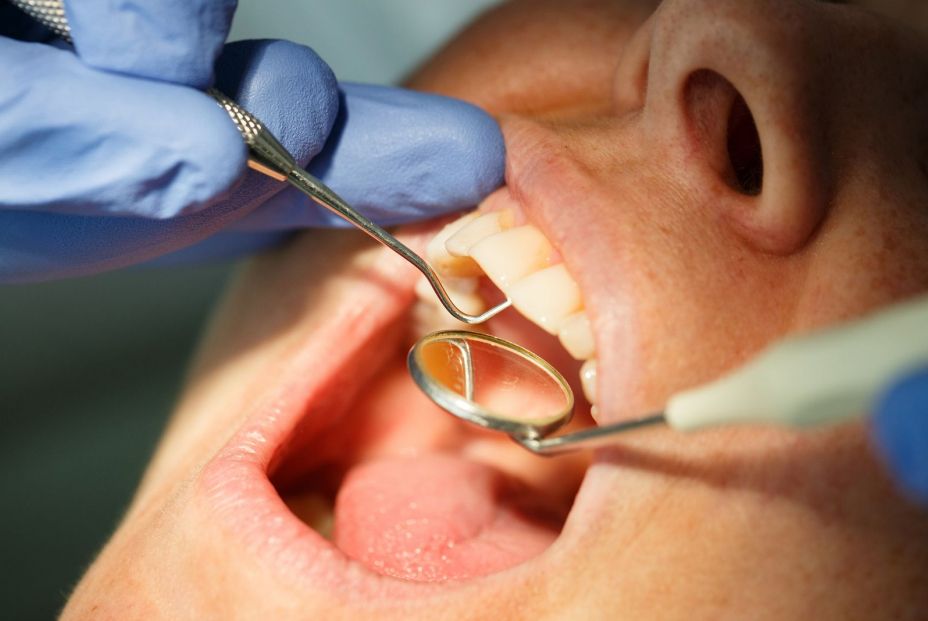 Las caries en personas mayores no se tratan en la mayoría de los casos, alertan los dentistas Las caries en personas mayores no se tratan en la mayoría de los casos, alertan los dentistas