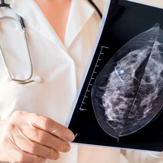 Radiólogos indican que el test de saliva no es un diagnóstico precoz para el cáncer de mama Radiólogos indican que el test de saliva no es un diagnóstico precoz para el cáncer de mama