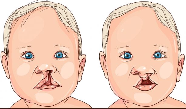El animal de donde viene el labio leporino. Diccionario anecdótico de términos médicos: 'L'