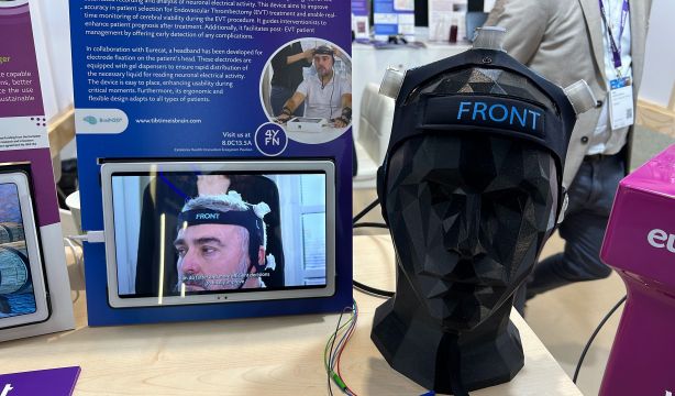 El MWC muestra una revolucionaria diadema para monitorizar los ictus al instante