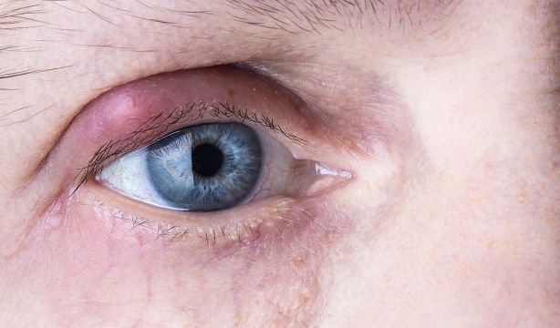 ¿Sabes de dónde vienen las palabras 'orgasmo' y 'orzuelo'? Diccionario anecdótico de términos médicos: 'O'