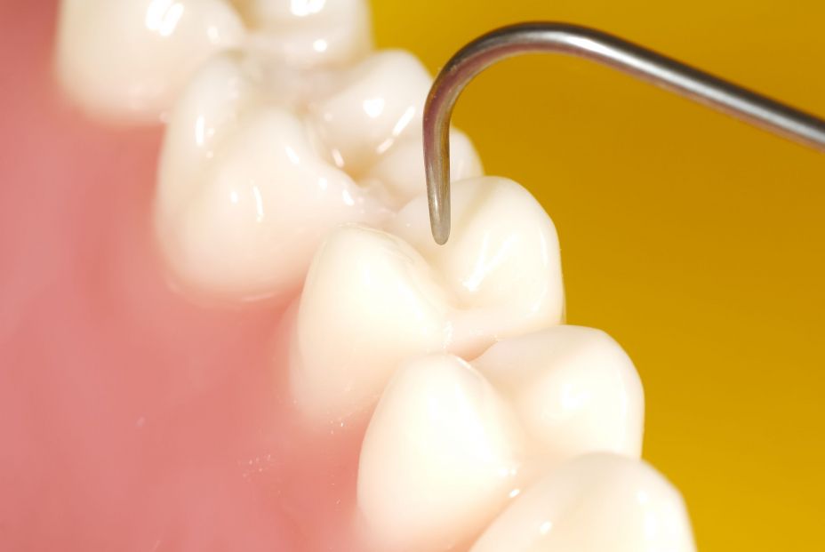 Este es el tiempo mínimo que debe durar el cepillado de dientes para que sea efectivo (Bigstock) Este es el tiempo mínimo que debe durar el cepillado de dientes para que sea efectivo (Bigstock)