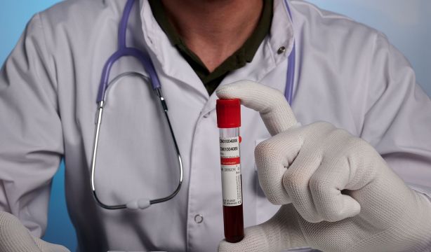 Un análisis de sangre consigue detectar el cáncer de colon en el 83% de los casos