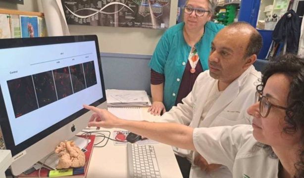 Una proteína abre nuevas oportunidades en la lucha contra el ataque al corazón (Instituto de Biomedicina de Sevilla)