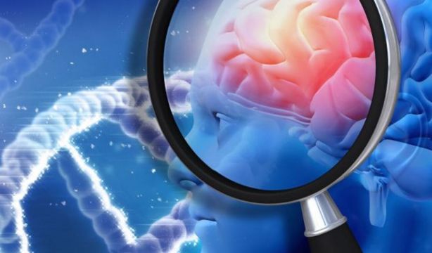 La inteligencia artificial puede detectar el alzhéimer siete años antes de los primeros síntomas (BigStock)