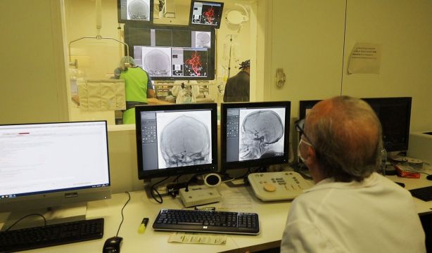 Una mayor edad biológica aumenta el riesgo de morir tras una hemorragia cerebral (Europa Press)