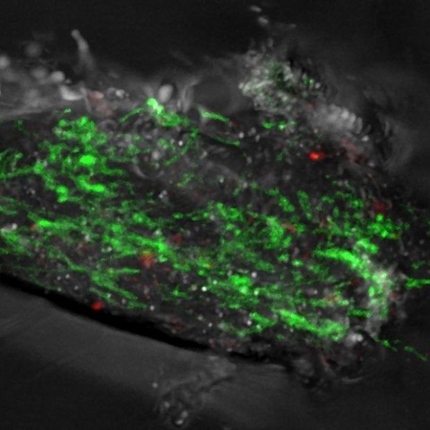 Las mutaciones del ADN de las mitocondrias podrían predecir el Parkinson. EuropaPress