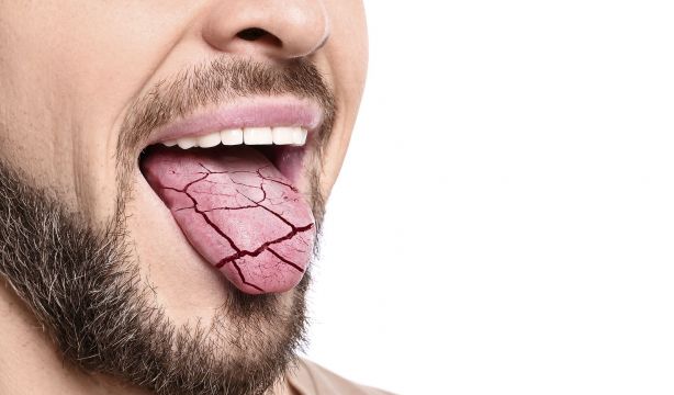 ¿Qué padece alguien que sufre 'xerostomia'? ¿Y 'xeroftalmia'?