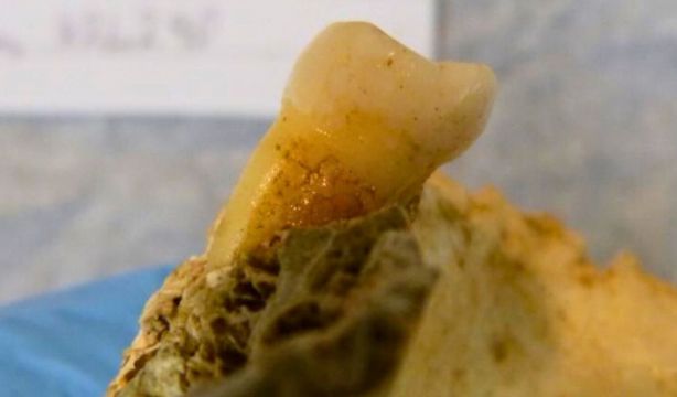 Hallazgos en dientes de la Edad de Bronce permiten analizar la evolución de la dieta humana