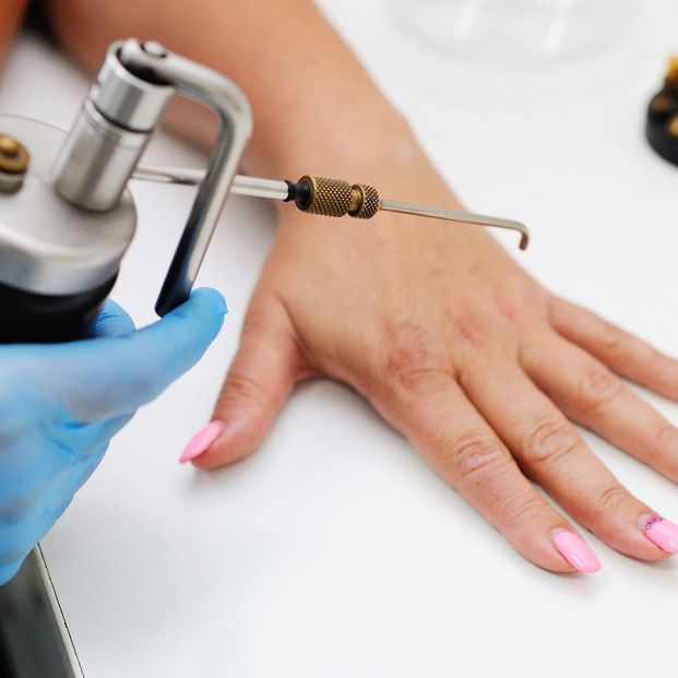 ¿Tienes muchas verrugas? Cómo puedes eliminarlas ¿Tienes muchas verrugas? Cómo puedes eliminarlas