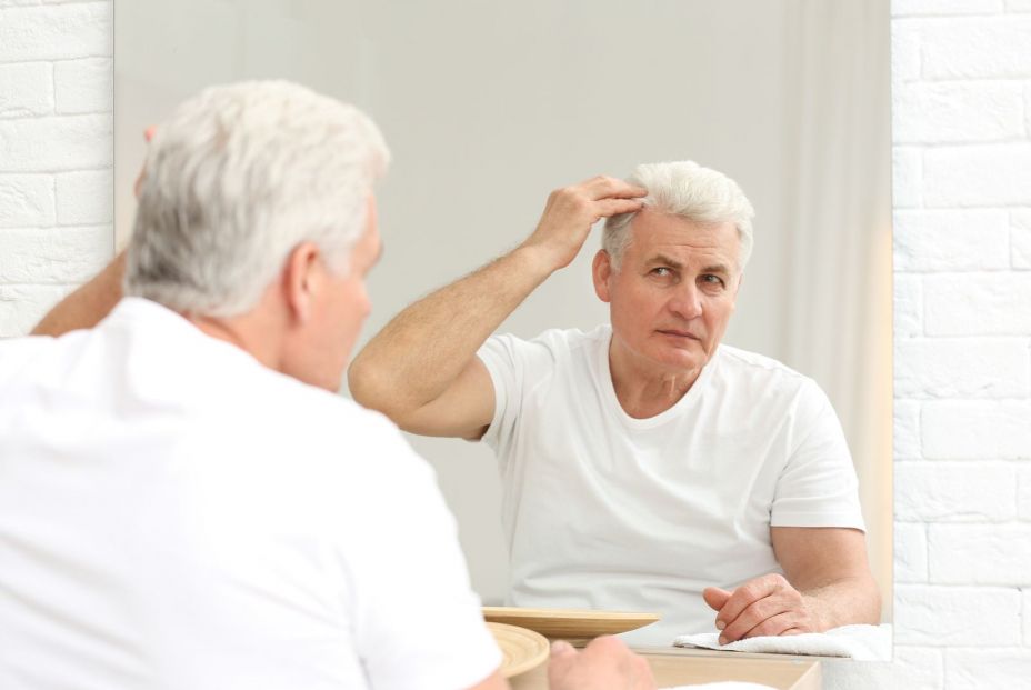 Alopecia difusa ¿en qué consiste esta pérdida capilar? Alopecia difusa ¿en qué consiste esta pérdida capilar?