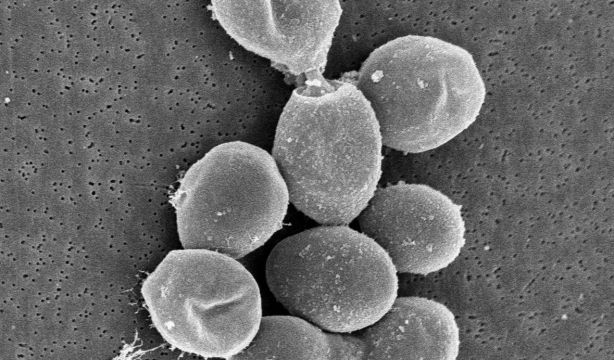 Descubren un método para producir serotonina a partir de la levadura del vino