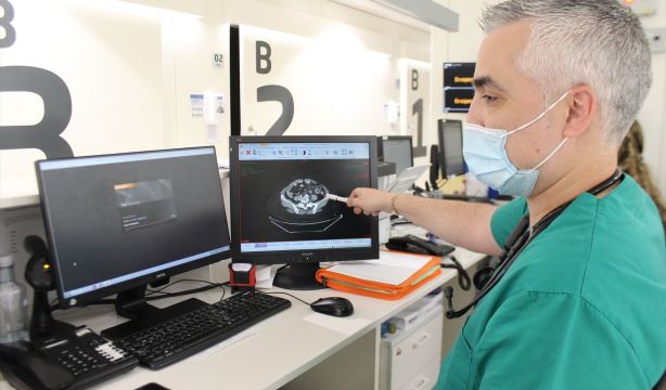 La extirpación del apéndice podría reducir el riesgo de padecer cáncer colorrectal (Europa Press)