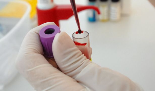 La sangre, una potencial herramienta para combatir el envejecimiento (Big Stock)