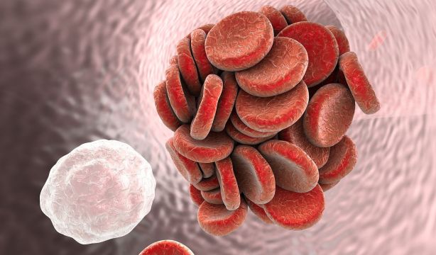 Descubren un nuevo factor de riesgo para sufrir trombos (BigStock)