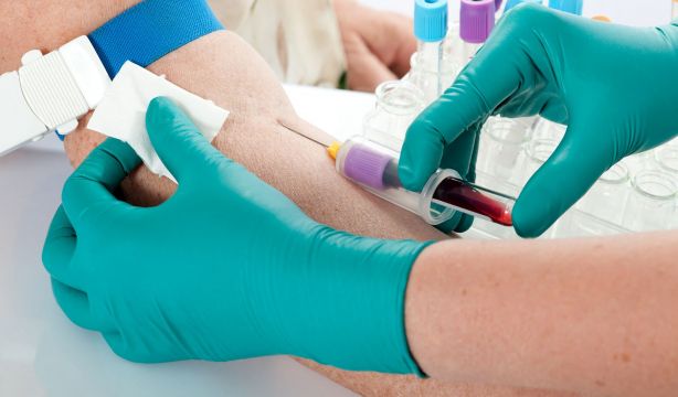 Unas proteínas en sangre predicen la aparición de cáncer hasta 7 años antes de su diagnóstico