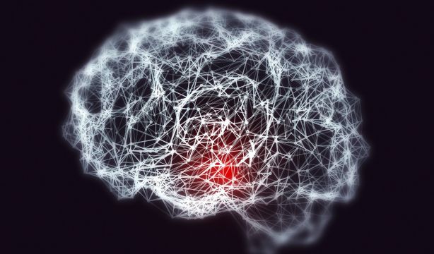 Logran predecir con Inteligencia Artificial la progresión de pacientes hacia la demencia 