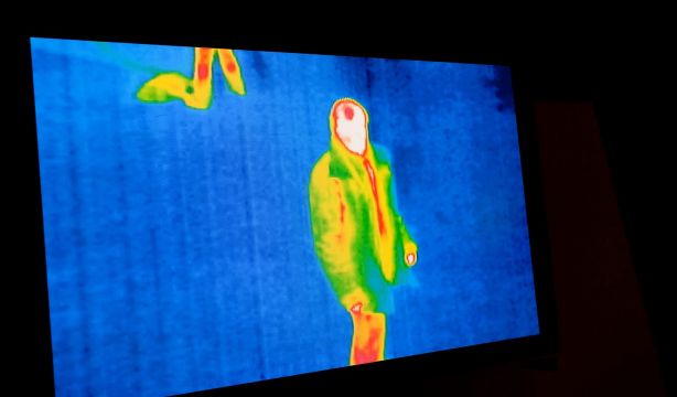 Las imágenes térmicas faciales + IA detectan con precisión la enfermedad de las coronarias
