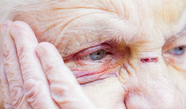 Las personas con demencia están más expuestas a abusos y malos tratos físicos y psicológicos