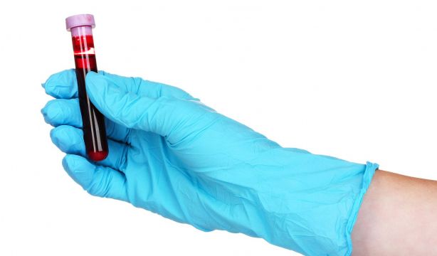 Un análisis de sangre podría predecir el párkinson siete años antes de los síntomas