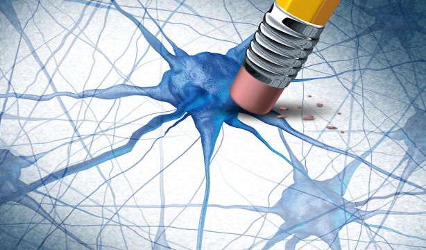 Esto es lo primero que se empieza a olvidar cuando se padece alzhéimer