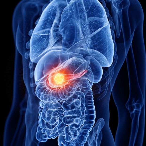 PPAR‑delta: la clave para combatir el cáncer de páncreas