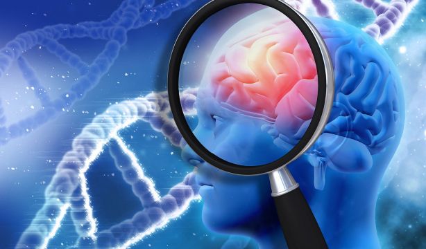 Los últimos estudios sobre el alzhéimer confirman la importancia de la detección precoz . (Big Stock) 