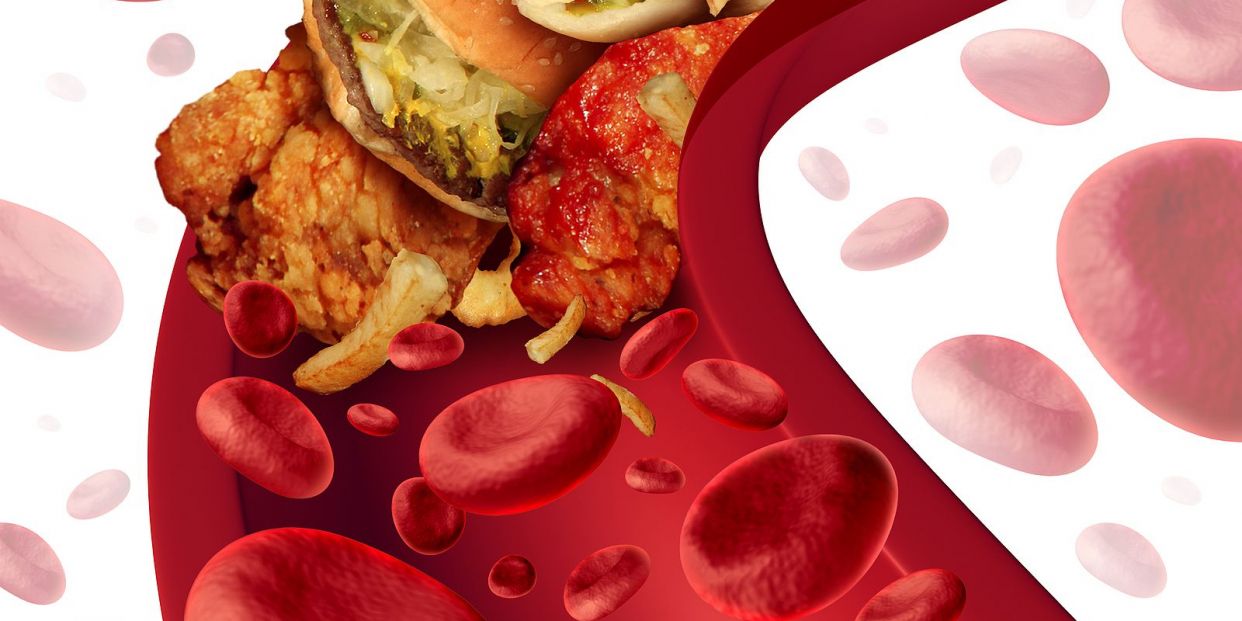 El aumento de peso en la juventud y mediana edad está relacionado con una mala salud cardiaca (Big Stock) El aumento de peso en la juventud y mediana edad está relacionado con una mala salud cardiaca (Big Stock)