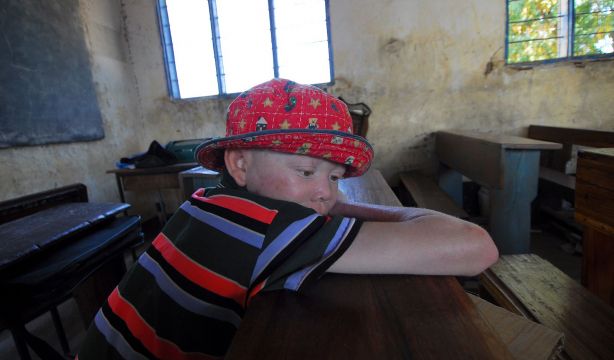 ISDIN extiende su proyecto de ayuda a personas con albinismo a Panamá