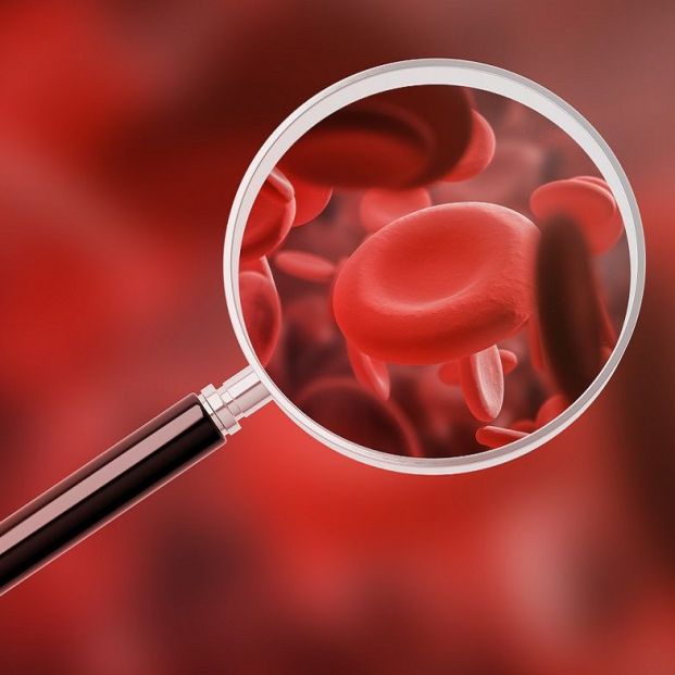 La edad avanzada es un factor de riesgo en la Leucemia linfocítica crónica 2 La edad avanzada es un factor de riesgo en la Leucemia linfocítica crónica 2