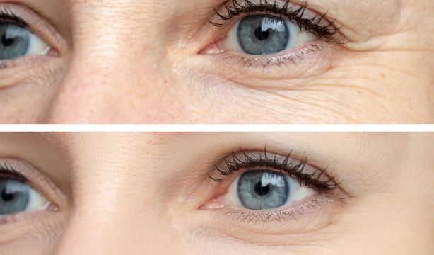 Esto dice la ciencia de la razón de nuestras arrugas en la cara