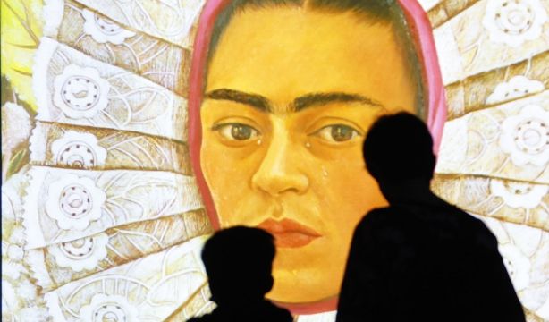 Diagnostican, 70 años después de su muerte, el raro síndrome que sufría Frida Kahlo
