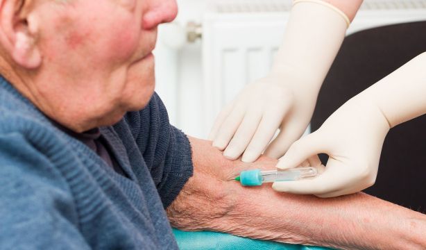 Identifican un nuevo factor de riesgo que aumenta un 61% el riesgo de ictus