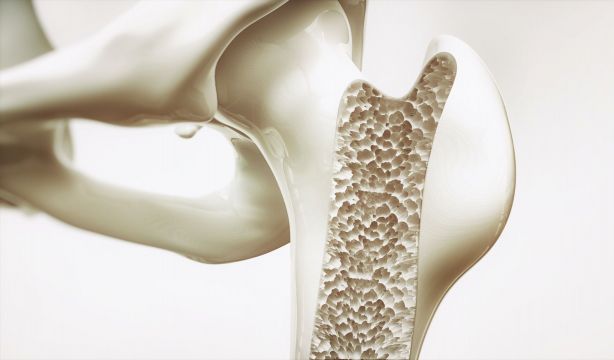 Más de la mitad de los mayores de 50 años sufren osteopenia y el 10,7% osteoporosis