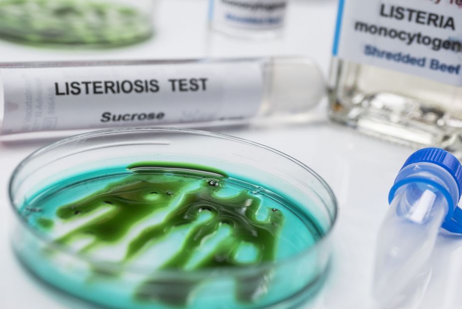 Nueva alerta por listeria en otra marca de carne mechada Nueva alerta por listeria en otra marca de carne mechada