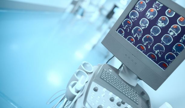 bigstock  207211324Necesitamos tu ayuda para tratar pacientes con ictus agudo