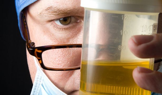 Demuestran que los análisis de orina pueden detectar enfermedades de forma precoz