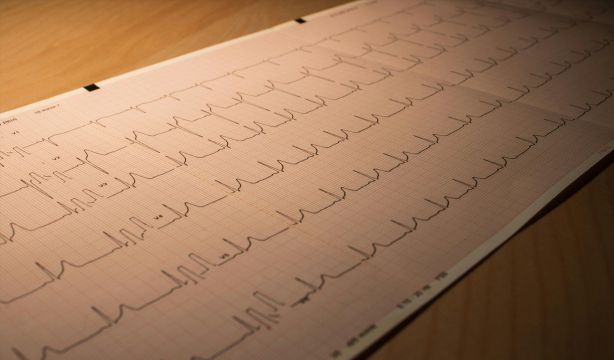 Las señales de infarto menos conocidas: no siempre aparece el dolor de pecho