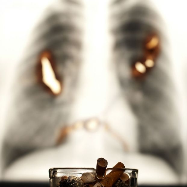 El tabaco, principal causa de cáncer de pulmón. Bigstock El tabaco, principal causa de cáncer de pulmón. Bigstock