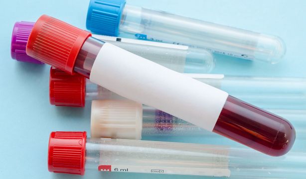 El efecto indeseado de tener niveles bajo es en sangre de calcio y magnesio