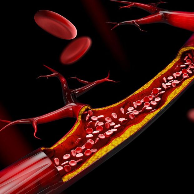 estatinas glaucoma estatinas glaucoma