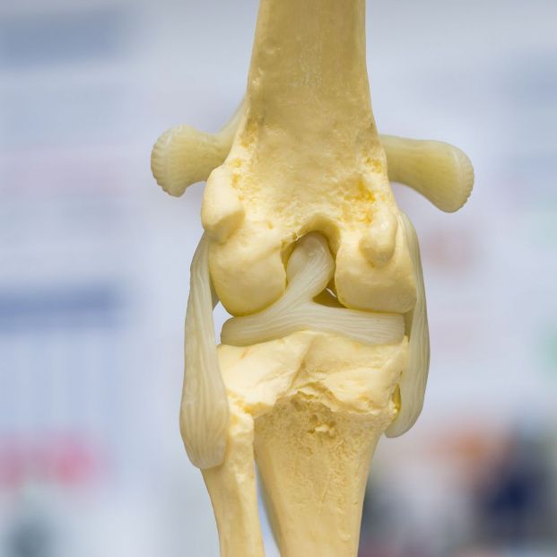 Luxación de rodilla Luxación de rodilla