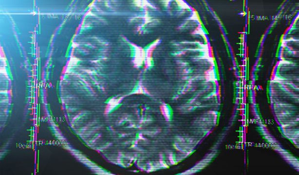 Nuevo hallazgo para tratar el alzhéimer: la clave está en los receptores NMDA