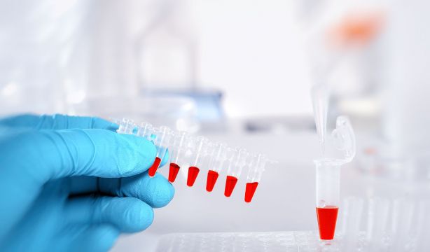 Detectan el riesgo de alzhéimer mediante un análisis de sangre con una precisión del 80%