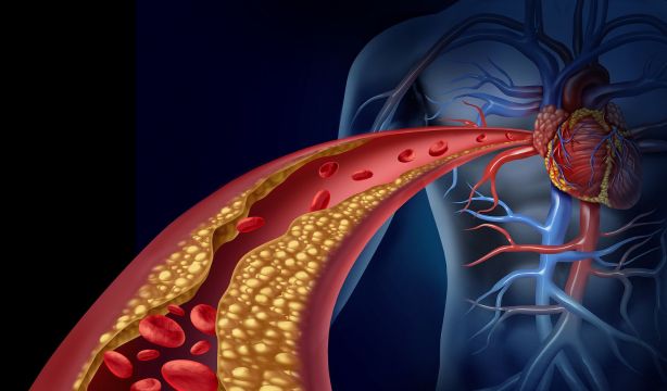 Un estudio vincula el riesgo cardiovascular con la gingivitis y el síndrome de ovario poliquístico