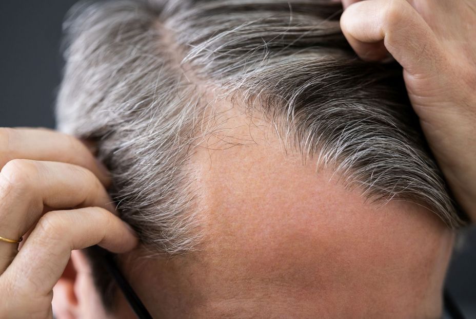 Esto es lo que debes hacer si comienzas a perder pelo