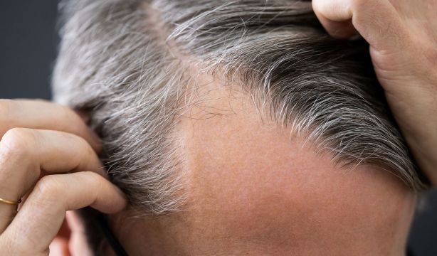 Esto es lo que debes hacer si comienzas a perder pelo