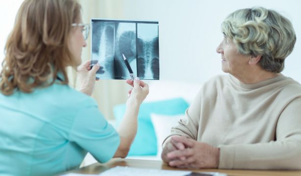 Estos son los tipos de cáncer que más se diagnosticarán en España en 2025